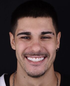 {{brizy_dc_image_alt imageSrc=